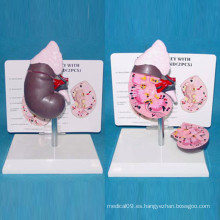 Modelo humano anatómico del riñón humano para la enseñanza médica (R110106)